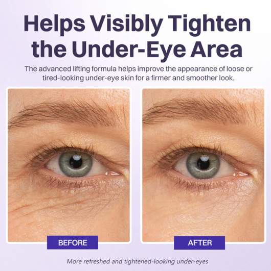 Siegen Instant Lift Eye Gel