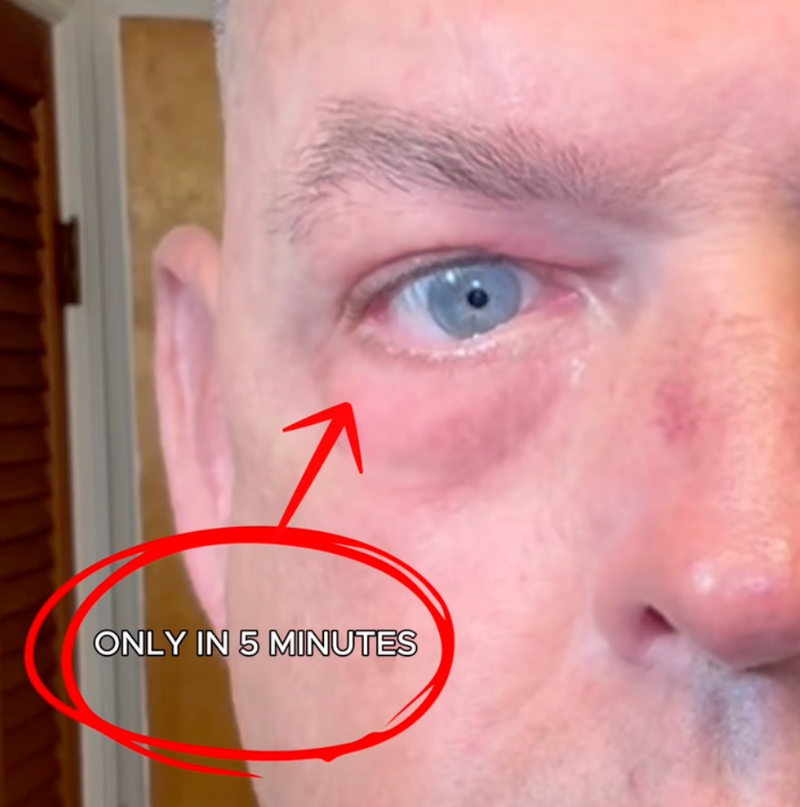 1. Visible Improvements in Just 5 Minutes — Supported by Clinical Testing