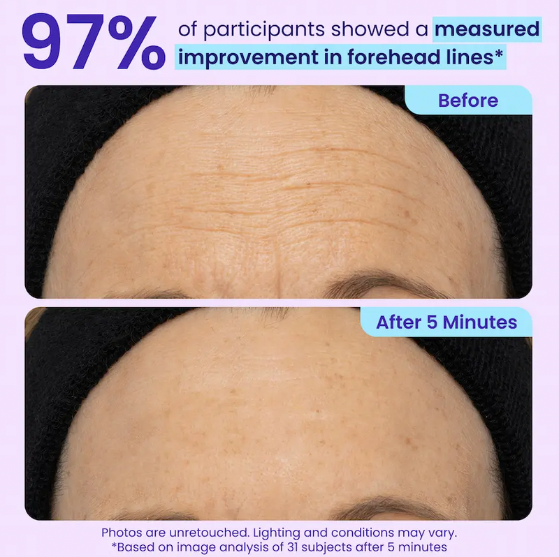 2. It Does More Than Target Puffiness